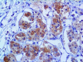 IHC of LH on an FFPE Pituitary Adenoma Tissue
